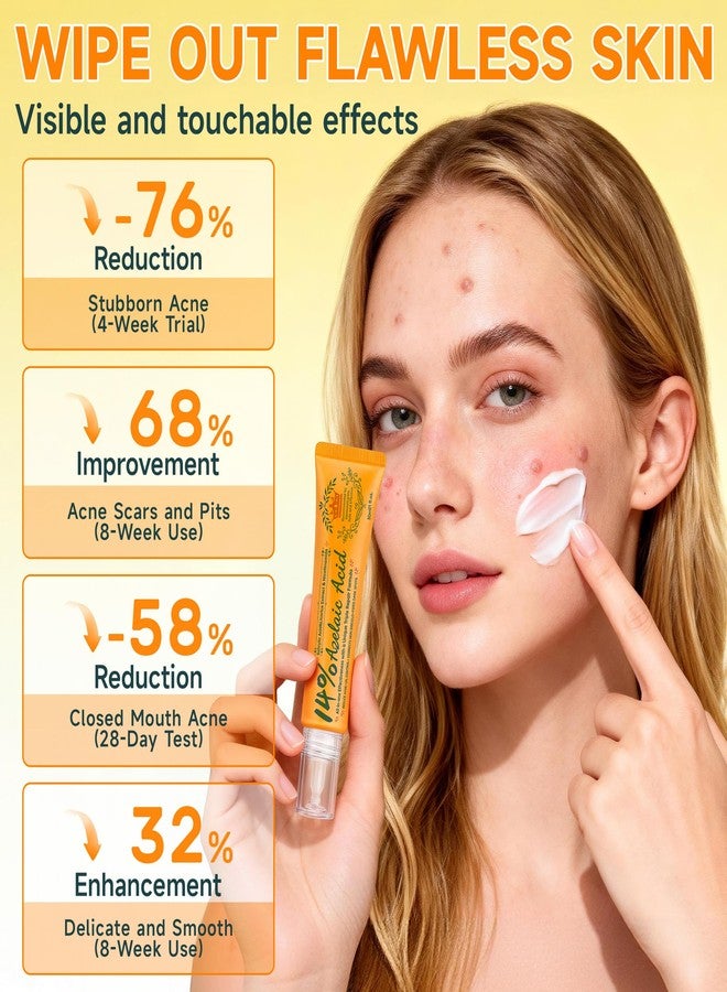 CHANGARLOAD 14% Azelaic Acid Acne Cream - Dark Spot Remover for Face, Acne Treatment & Acne Spot Treatment Salicylic Acid & Niacinamide – Redness Reducing Skin Care,Evens Tone & Soothe Irritation & Rosacea，1oz - Image 2